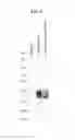 Fig. 11 - Anti FGF23 antibody and a pharmaceutical composition comprising the same
