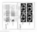 Fig. 15 - Compositions and methods for treatment of cancer