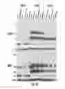 Fig. 25 - Binding molecules specific for HER3 and uses thereof