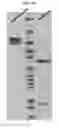 Fig. 03 - Dual-targeting protein binding specifically to DLL4 and VEGF and use thereof
