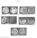 Fig. 03 - WELLBORE SERVICING COMPOSITIONS AND METHODS OF MAKING AND USING SAME
