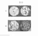 Fig. 04 - WELLBORE SERVICING COMPOSITIONS AND METHODS OF MAKING AND USING SAME