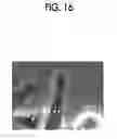 Fig. 11 - Observation image capturing and evaluation device, method, and program