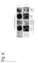 Fig. 17 - Osteoblast and method for preparing same