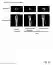 Fig. 31 - Osteoblast and method for preparing same