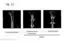 Fig. 32 - Osteoblast and method for preparing same