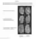 Fig. 17 - PEG-urate oxidase conjugates and use thereof