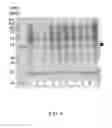 Fig. 05 - Coordinated coexpression of thrombin