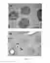 Fig. 02 - Probiotic bacteria comprising metals, metal nanoparticles and uses thereof