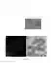 Fig. 03 - Probiotic bacteria comprising metals, metal nanoparticles and uses thereof