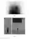 Fig. 04 - Probiotic bacteria comprising metals, metal nanoparticles and uses thereof