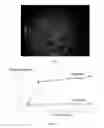 Fig. 05 - Probiotic bacteria comprising metals, metal nanoparticles and uses thereof