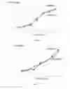 Fig. 06 - Probiotic bacteria comprising metals, metal nanoparticles and uses thereof