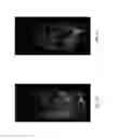 Fig. 09 - Probiotic bacteria comprising metals, metal nanoparticles and uses thereof