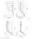 Fig. 06 - Recombinant microorganisms exhibiting increased flux through a fermentation pathway