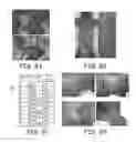 Fig. 10 - HETEROZYGOUS MODIFICATIONS OF TUMOR SUPPRESSOR GENES