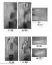 Fig. 25 - Plants expressing cell wall degrading enzymes and expression vectors