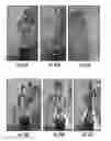 Fig. 30 - Plants expressing cell wall degrading enzymes and expression vectors
