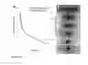 Fig. 04 - AMDINOCILLIN FOR RAPID DETERMINATION OF SUSCEPTIBILITY TO BETA-LACTAM ANTIBIOTICS