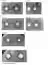 Fig. 20 - AMDINOCILLIN FOR RAPID DETERMINATION OF SUSCEPTIBILITY TO BETA-LACTAM ANTIBIOTICS