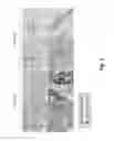 Fig. 05 - In situ hybridization method and buffer