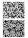Fig. 03 - Spheroidal graphite cast iron