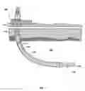 Fig. 02 - Borided metals and downhole tools, components thereof, and methods of boronizing metals, downhole tools and components