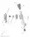 Fig. 16 - Mechanical touch faucet
