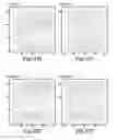 Fig. 17 - Systems and methods for casing detection using resonant structures