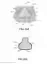 Fig. 04 - Plated polymer compressor