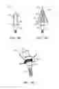 Fig. 16 - Systems and methods for archery equipment