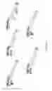 Fig. 17 - ELASTIC PROJECTILE PROPULSION SYSTEMS AND METHODS