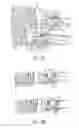 Fig. 29 - ELASTIC PROJECTILE PROPULSION SYSTEMS AND METHODS