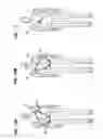 Fig. 08 - Portable firearm carrier