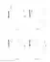 Fig. 07 - Apparatus, systems and methods for improving visual outcomes for pseudophakic patients