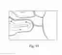 Fig. 15 - METHODS AND APPARATUS FOR THE MANIPULATION OF PARTICLE SUSPENSIONS AND TESTING THEREOF