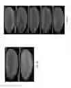 Fig. 20 - Multiview light-sheet microscopy