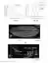 Fig. 22 - Multiview light-sheet microscopy