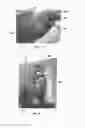 Fig. 09 - Gas emission detection device, system and method
