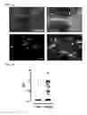Fig. 02 - Means and methods for diagnosing and treating multiple sclerosis