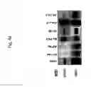 Fig. 12 - Activated HER3 as a marker for predicting therapeutic efficacy