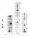 Fig. 02 - SENSITIVE DIAGNOSTIC ASSAY FOR INCLUSION BODY MYSITIS