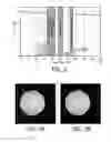 Fig. 03 - Reducing interference in a combined assembly for MRI and nuclear imaging