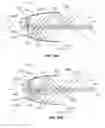 Fig. 14 - Systems and methods for multiple-pass stripping of an optical fiber coating