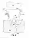 Fig. 03 - REMOVABLE OPTICAL ASSEMBLY