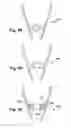 Fig. 10 - REMOVABLE OPTICAL ASSEMBLY