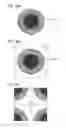 Fig. 16 - Confocal scanner and confocal microscope