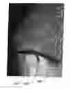 Fig. 01 - Retaining device