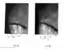 Fig. 04 - Retaining device