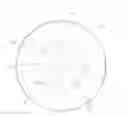Fig. 01 - Presbyopia contact lens set